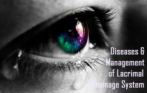 1310lacrimal_meeting_2014.jpg